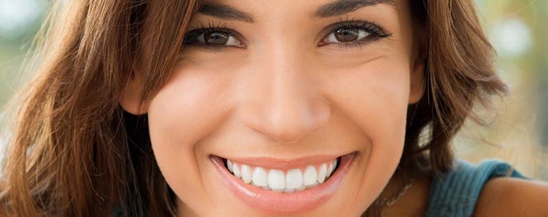 Cuidado de las carillas dentales de composite