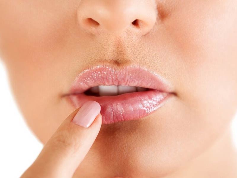 La exposición solar desencadena herpes labial