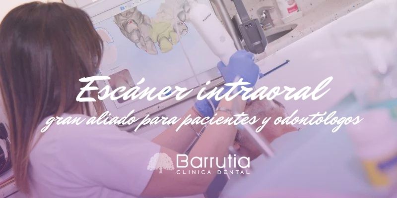 Escáner intraoral, gran aliado para pacientes y dentistas