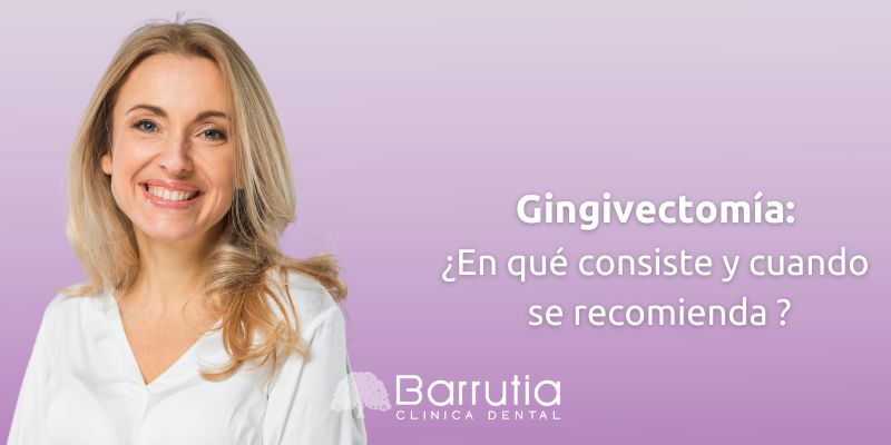 Gingivectomía: en qué consiste y en qué casos se recomienda