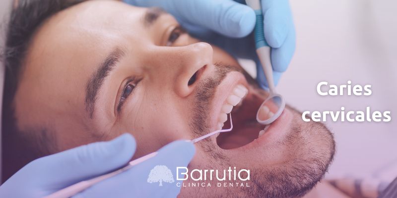 Caries cervicales