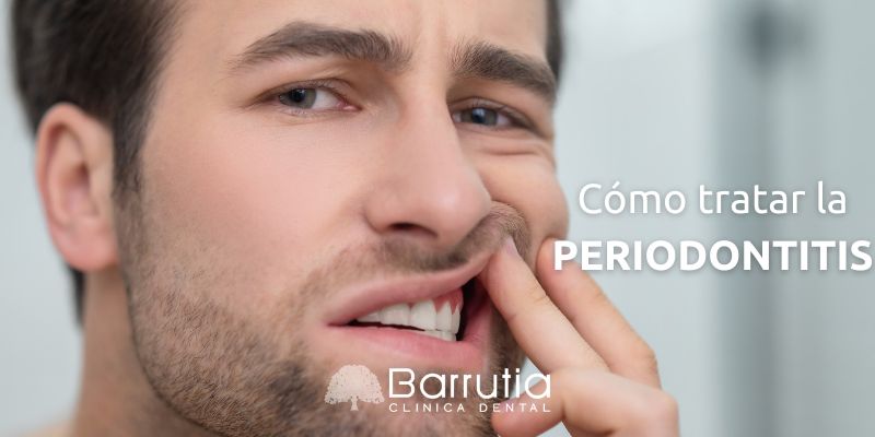 Cómo tratar la periodontitis