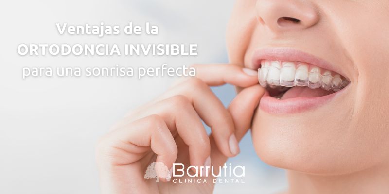 Ventajas de la ortodoncia invisible para una sonrisa perfecta
