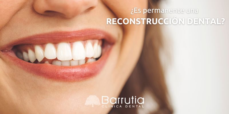 ¿Es permanente una reconstrucción dental?