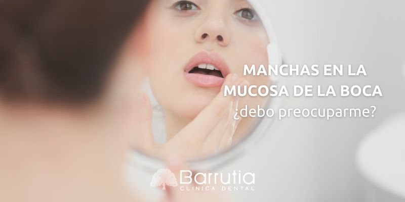 Manchas en la mucosa de la boca ¿debo preocuparme?