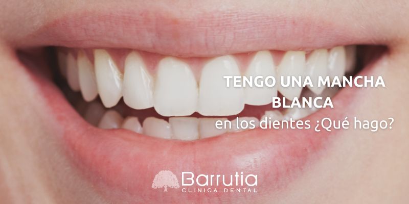 Tengo una mancha blanca en los dientes ¿Qué hago?
