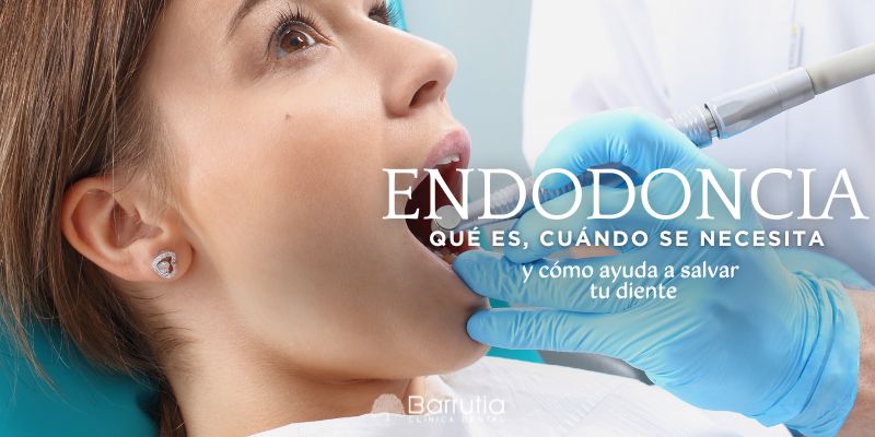 Endodoncia: qué es, cuándo se necesita y cómo ayuda a salvar tu diente
