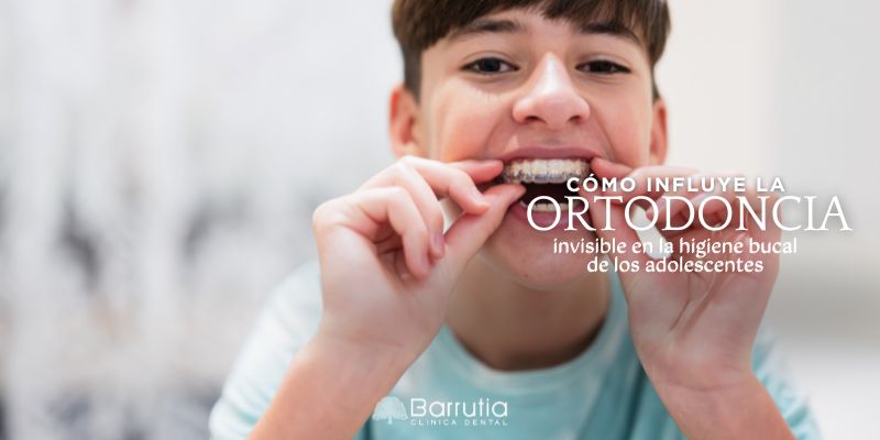 Cómo influye la ortodoncia invisible en la higiene bucal de los adolescentes