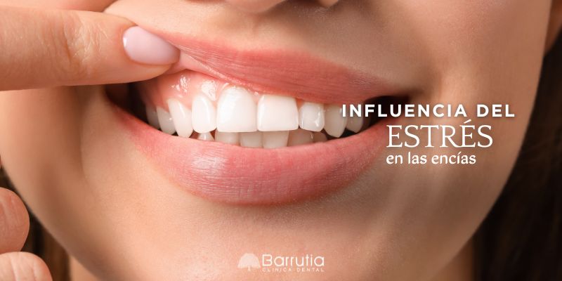 ¿Cómo afecta el estrés a las encías?